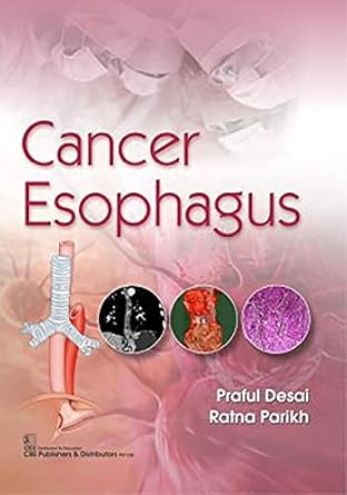 Cancer Esophagus (PB)