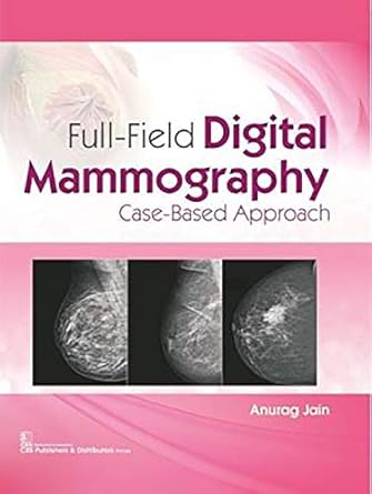 Full-Field Digital Mammography: Case-Based Approach (HB)