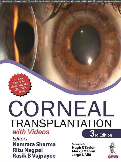 CORNEAL TRANSPLANTATION