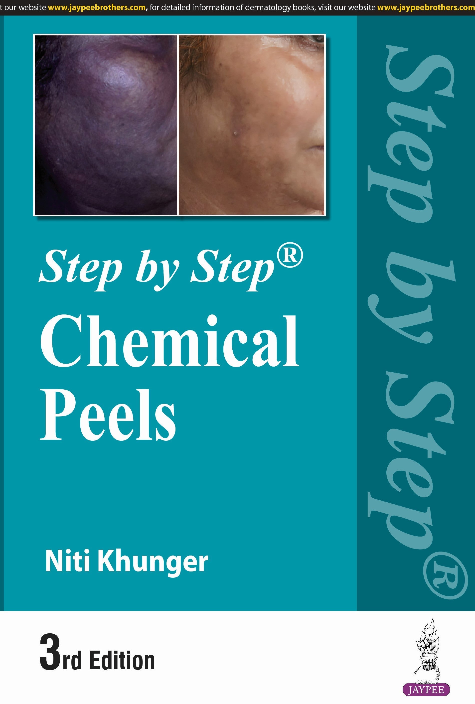 STEP BY STEP CHEMICAL PEELS