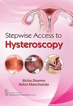 Stepwise Access to Hysteroscopy (HB)