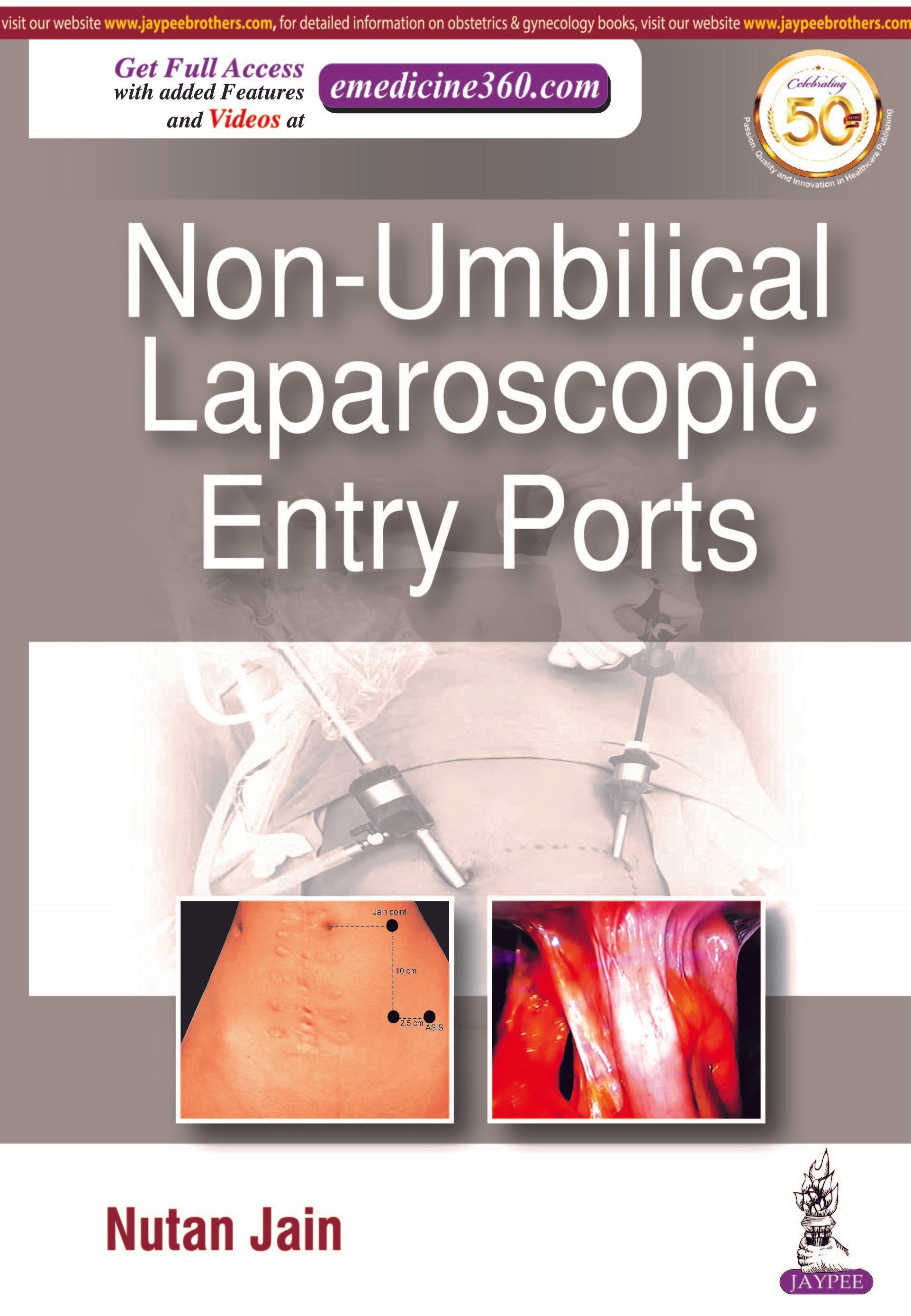 NON-UMBILICAL LAPAROSCOPIC ENTRY PORTS