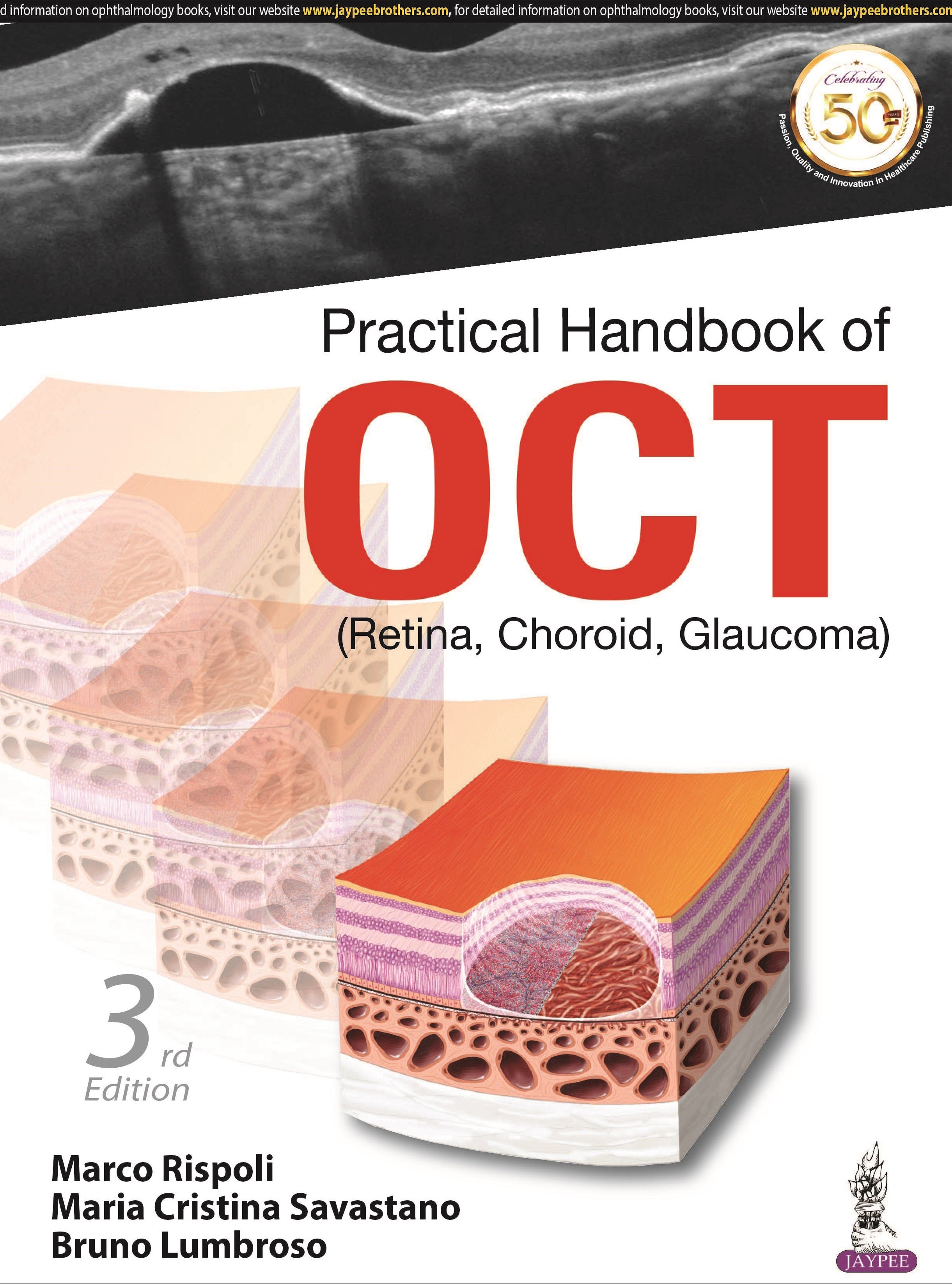 PRACTICAL HANDBOOK OF OCT (RETINA, CHOROID, GLAUCOMA)