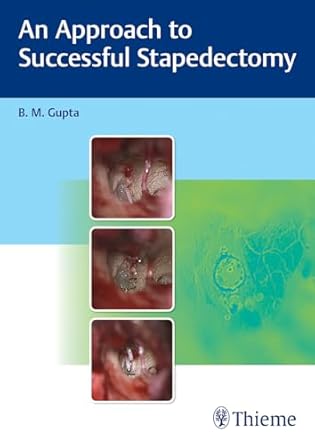 An Approach to Successful Stapedectomy