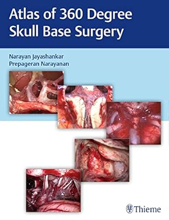 Atlas of 360 Degree Skull Base Surgery 1st Ed.