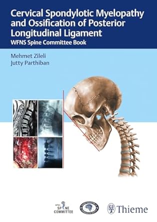 Cervical Spondylotic Myelopathy and OPLL 1st Ed.