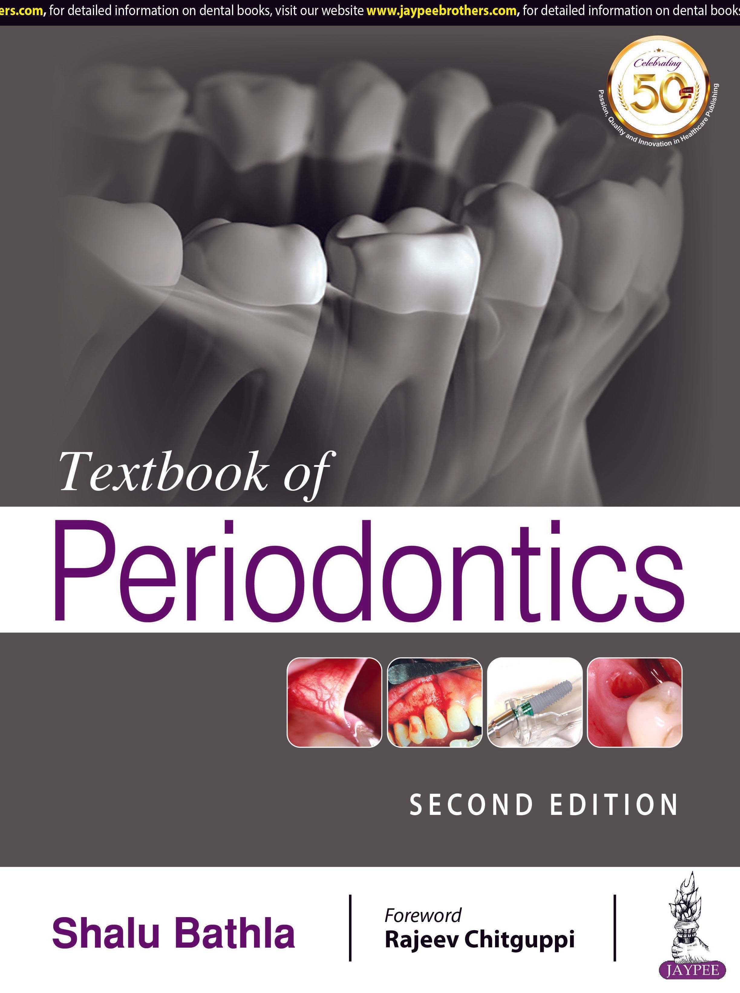 TEXTBOOK OF PERIODONTICS