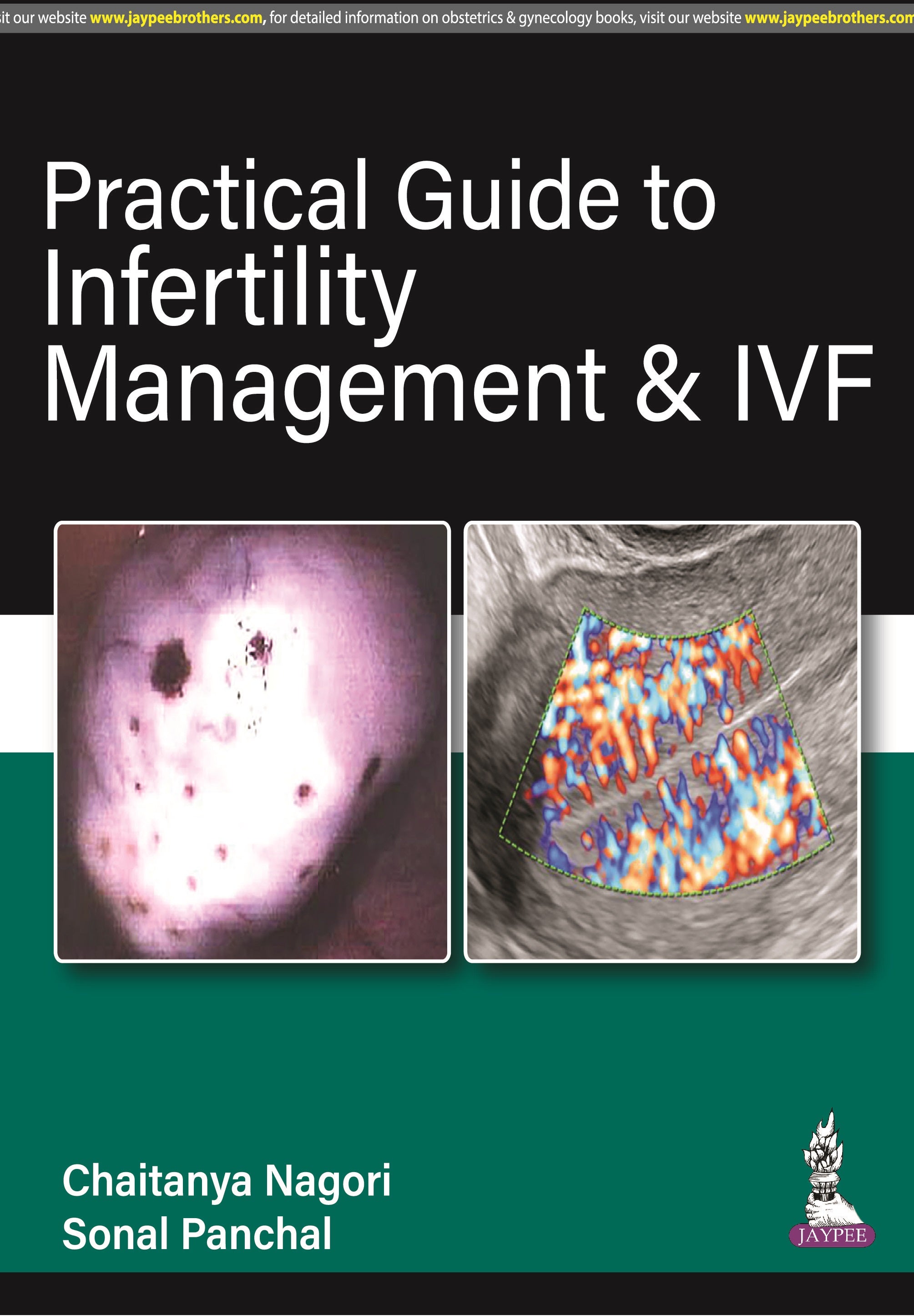 PRACTICAL GUIDE TO INFERTILITY MANAGEMENT & IVF