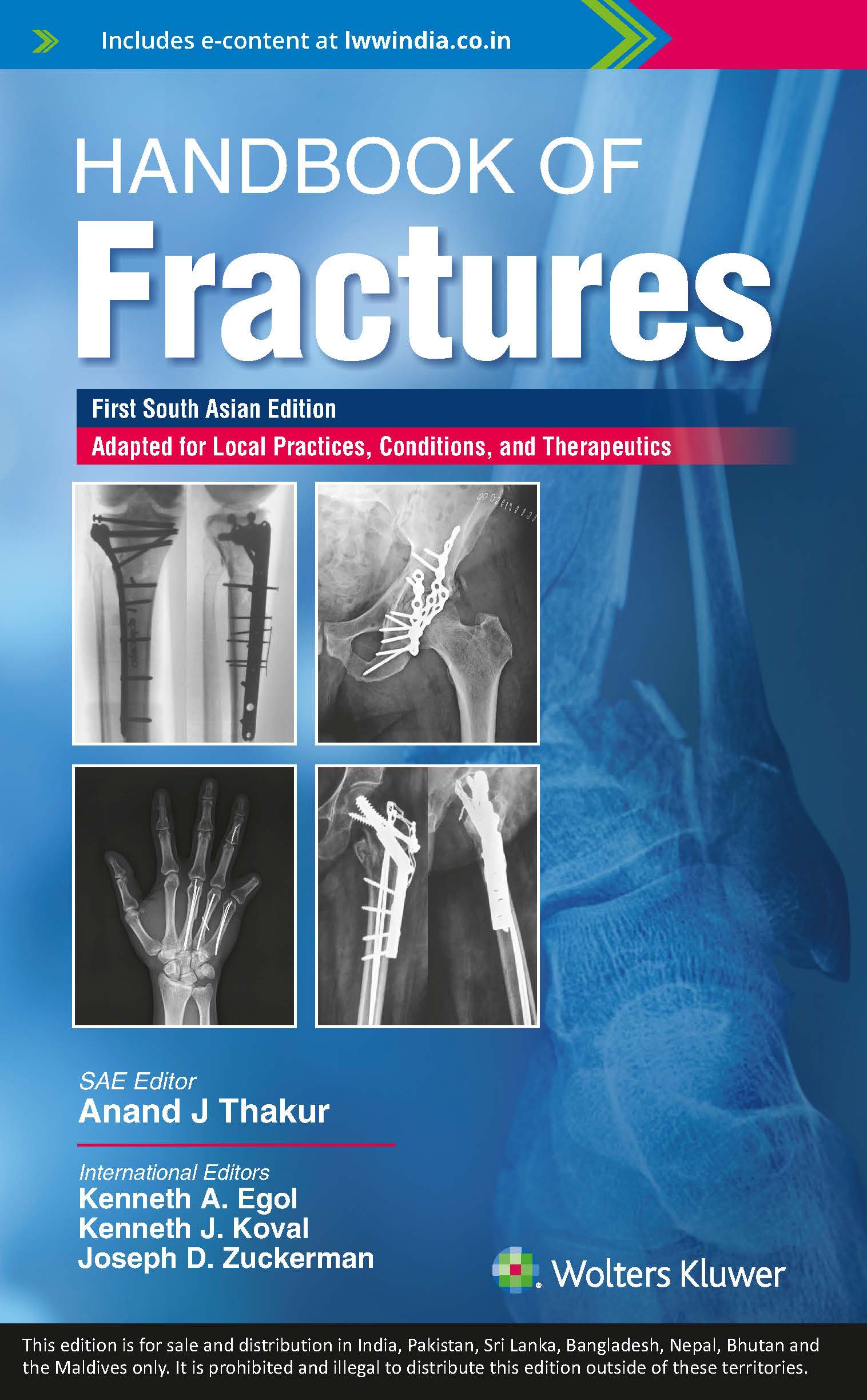 Handbook of fractures, 1st South Asian ed