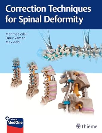 Correction Technoques for Spine Deformoty 1st Ed.