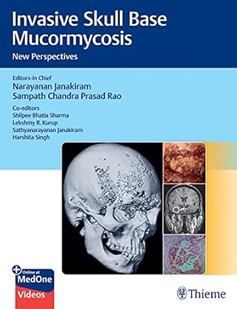 Invasive Skull Base Mucormycosis 1st Ed.