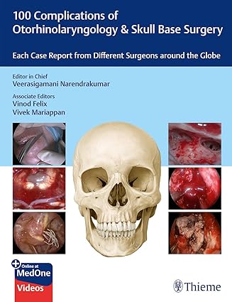 100 Complications of Otorhinolaryngology & Skull Base Surgery 1st Ed.