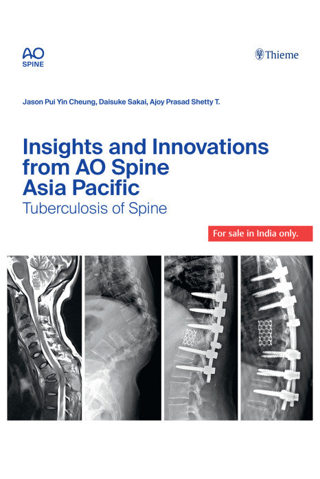 Insights and Innovations from AO Spine Asia Pacific: TB Spine