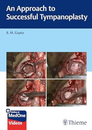 An Approach to Successful Tympanoplasty 1st Ed.