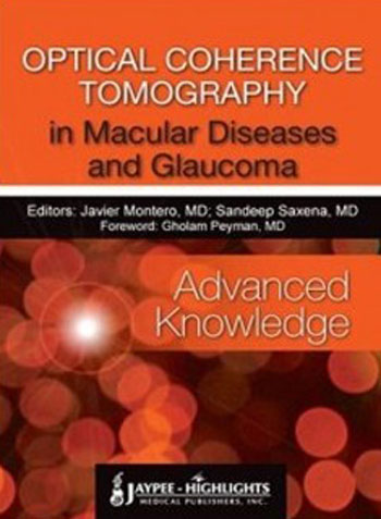 OPTICAL COHERENCE TOMOGRAPHY IN MACULAR DISEASES AND GLAUCOMA(ADVANCED KNOWLEDGE)