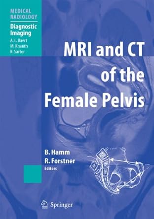 MRI AND CT OF THE FEMALE PELVIS