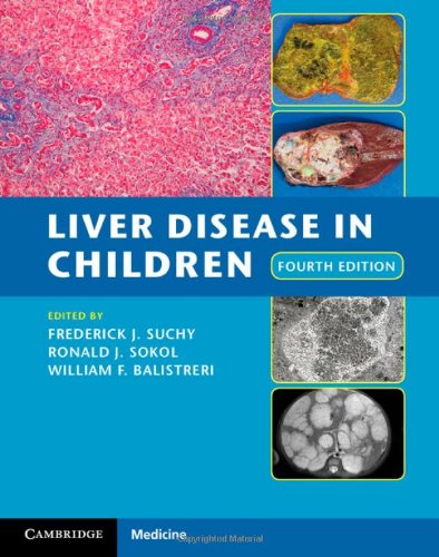 O.E.LIVER DISEASE IN CHILDREN