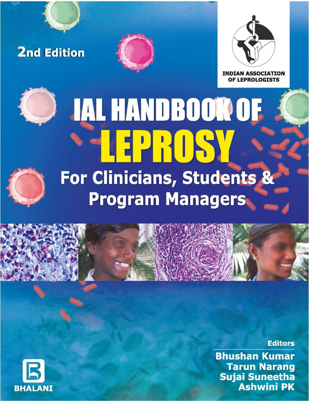IAL HANDBOOK OF LEPROSY